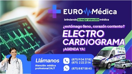 Electrocardiograma
